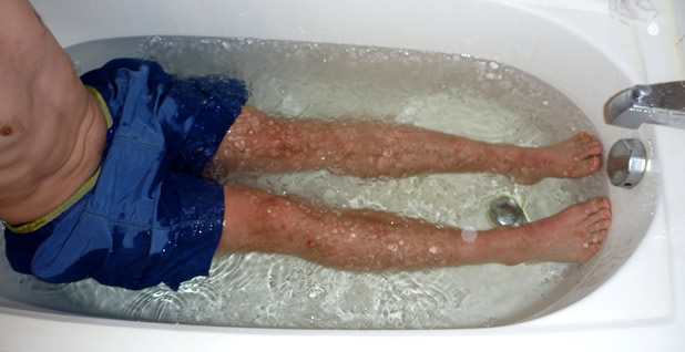 Ледена баня (Ice Bath)